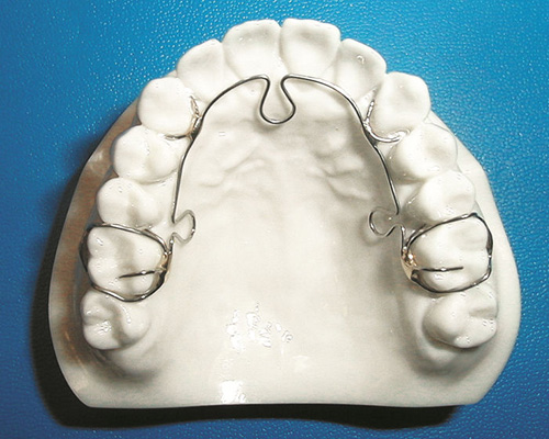 Image of teeth utilizing ALF Appliance