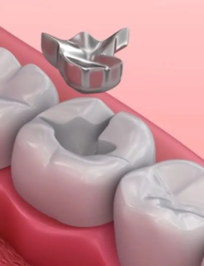 Triple certified in safe mercury removal, assuring utmost safety for the patients, employees & guests.