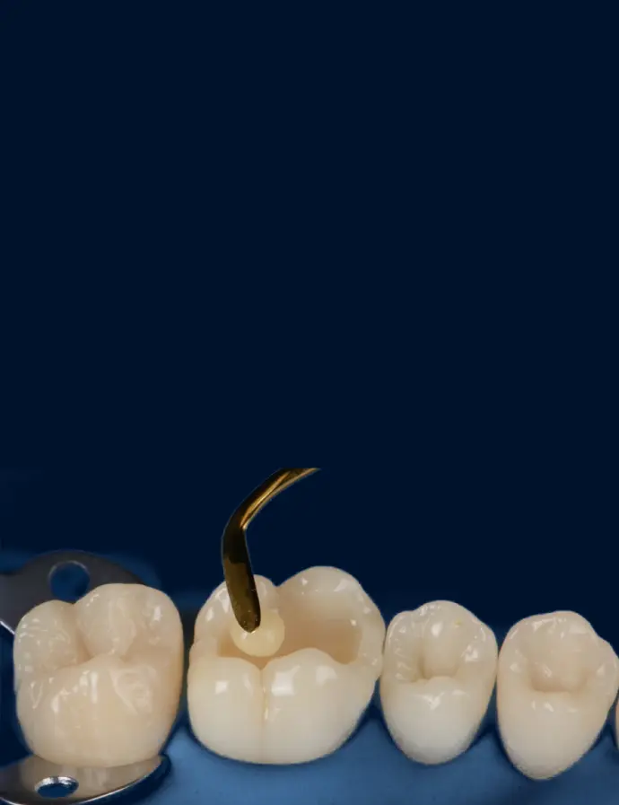 Biomimetic dentistry, literally meaning to mimic what is life-like, aims to replicate the natural properties and functions of teeth.